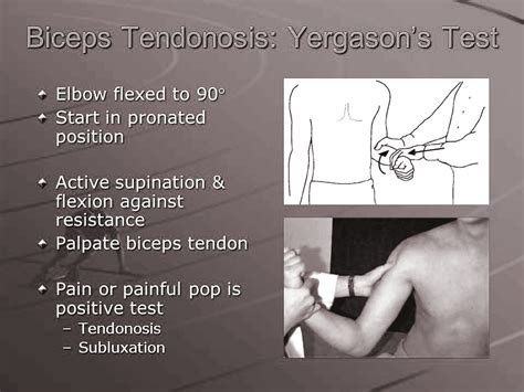 positive yergason's test shoulder